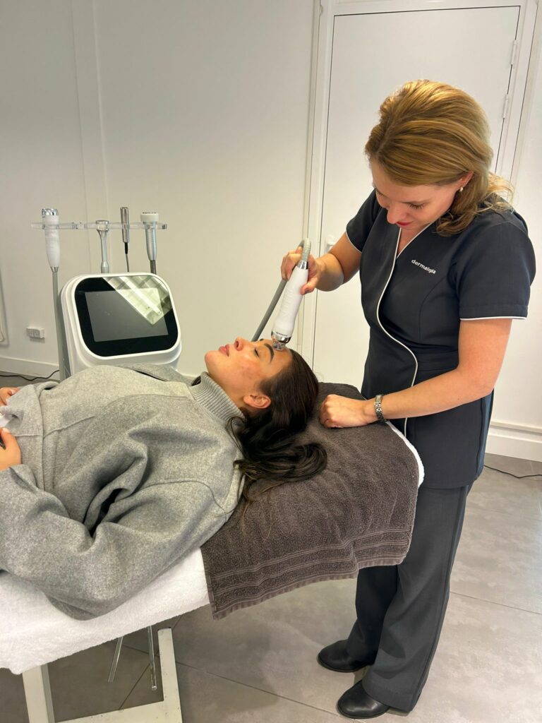 rf microneedling
