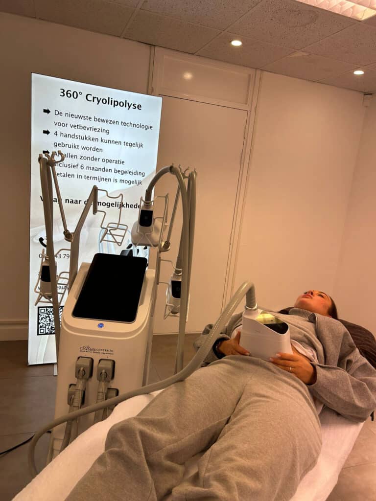 cryolipolyse